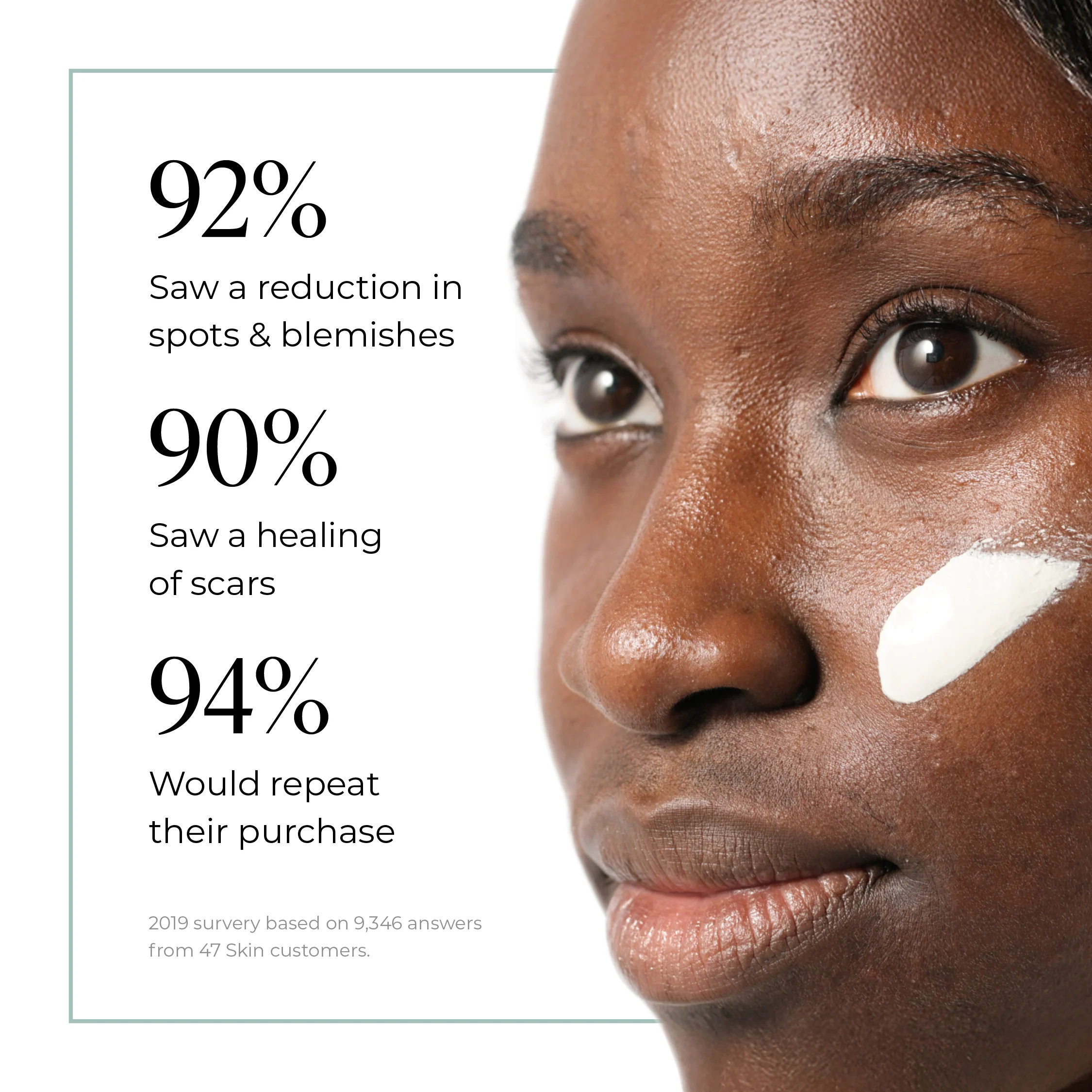 Exfoliating Skin Treatment for persistent, stubborn and cystic blemishes - Image 6
