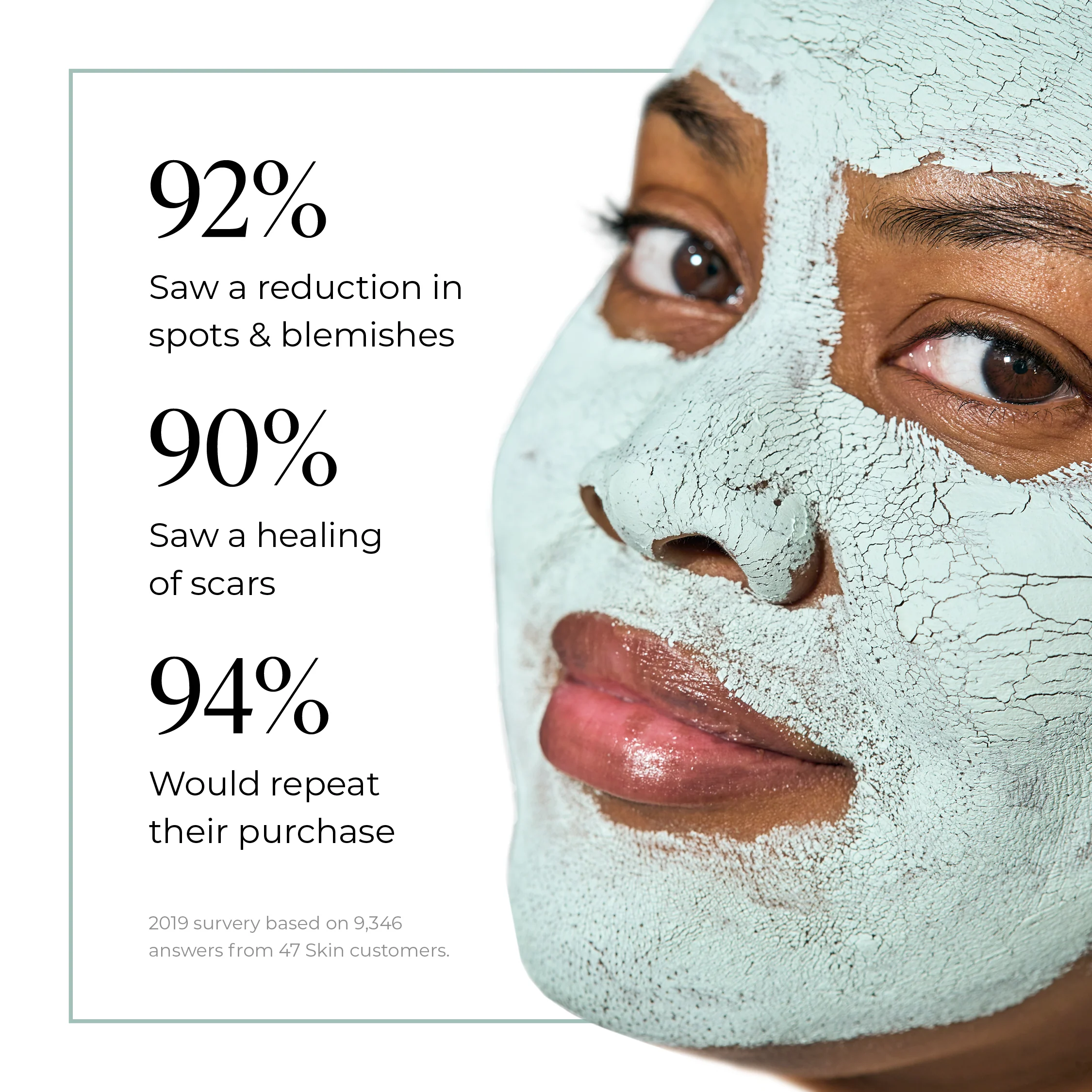 Anti-Blemish & Scar Repair Blue Clay Mask - Image 6